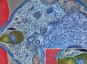 PALUDISME anticorps monoclonal pour prévenir