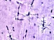 ÉPILEPSIE réponse peut-être dans microglie
