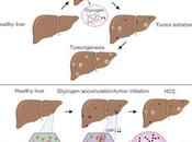 #Cell #glycogène #foie #tumeurhépatique L'accumulation glycogène séparation phases entraînent l'initiation d'une tumeur hépatique