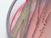 INFECTION URINAIRE pyélonéphrite L’antibiotique passé surmonte résistance