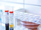 RISQUE CARDIOVASCULAIRE gènes facteurs toxines bactériennes dans sang