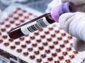 Demande marché détection cancer basée l’ADN, analyse tendances développements récents 2028