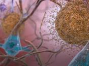 ALZHEIMER prédictive déclin, même bonne santé cognitive