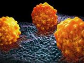 OBÉSITÉ CANCER L’exposition cellulaire lipides question dans cancérogenèse