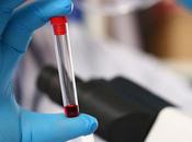 CANCER nouvelle immunothérapie fait flancher tumeur