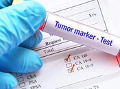 CANCER PROSTATE Découverte d'une protéine métastase