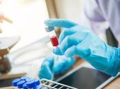 MÉTABOLOMIQUE promesses dans diagnostic médico-légal