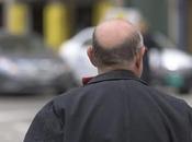 Qu'est-ce qu'une GREFFE CHEVEUX