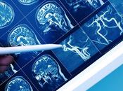 ÉPILEPSIE L’approche "microvasculaire&amp;quot; pour prévenir crises