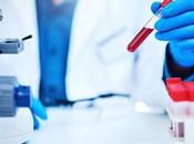 CANCER nouvelle tests sanguins détection précoce