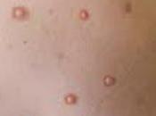 nouvelle technologie facilite réparation fractures cheville