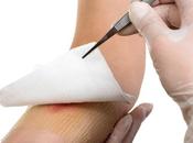 CICATRISATION Mettre l’horloge côté pour mieux cicatriser