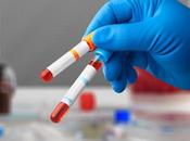 FONCTION RÉNALE Petit dysfonctionnement gros problèmes santé